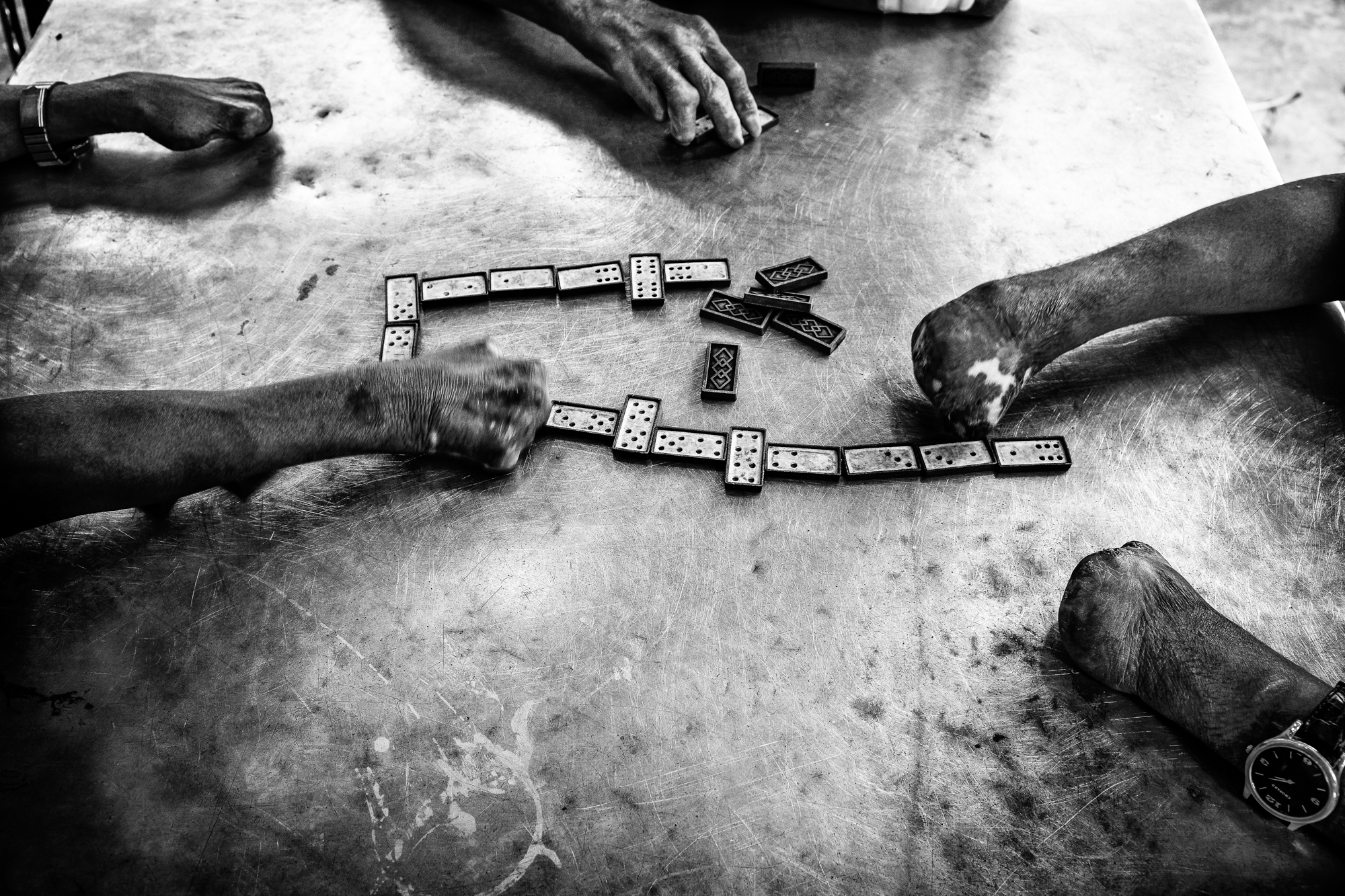 Resident patients at Ben San leprosy center, near Saigon, Vietnam, spend their days playing dominos, which they do with ease and skill, despite their loss of digits, a common syptom of the disease.