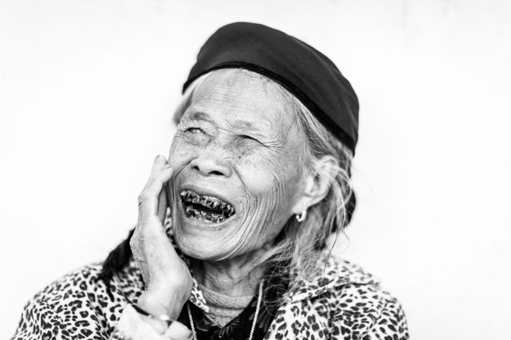 A portrait of a woman suffering from leprosy at a colony in northern Vietnam